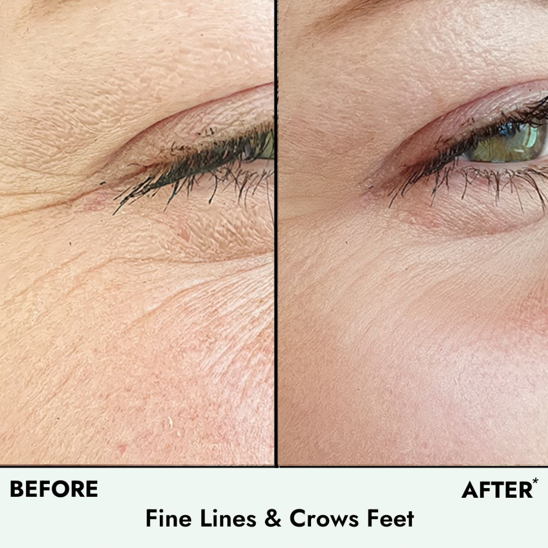 Instant Lift & Firm Anti-Wrinkle Eye Serum