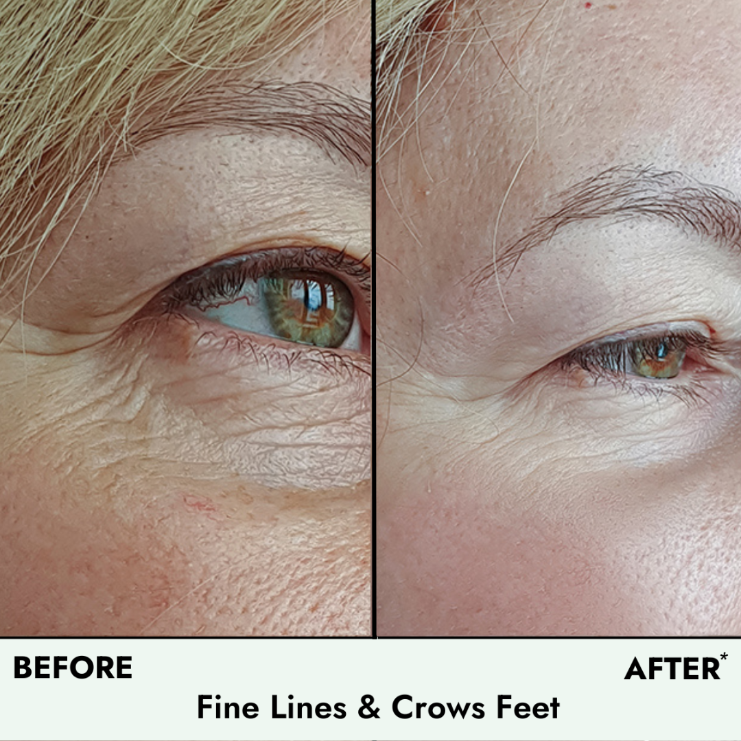 Instant Lift & Firm Anti-Wrinkle Eye Serum