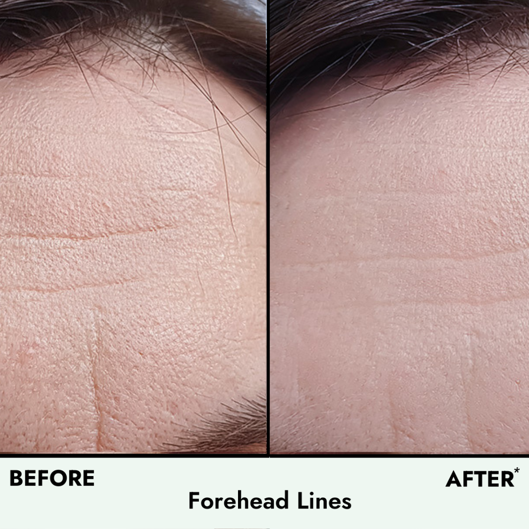 Anti-Aging Dynamic Duo - Renew & Glow