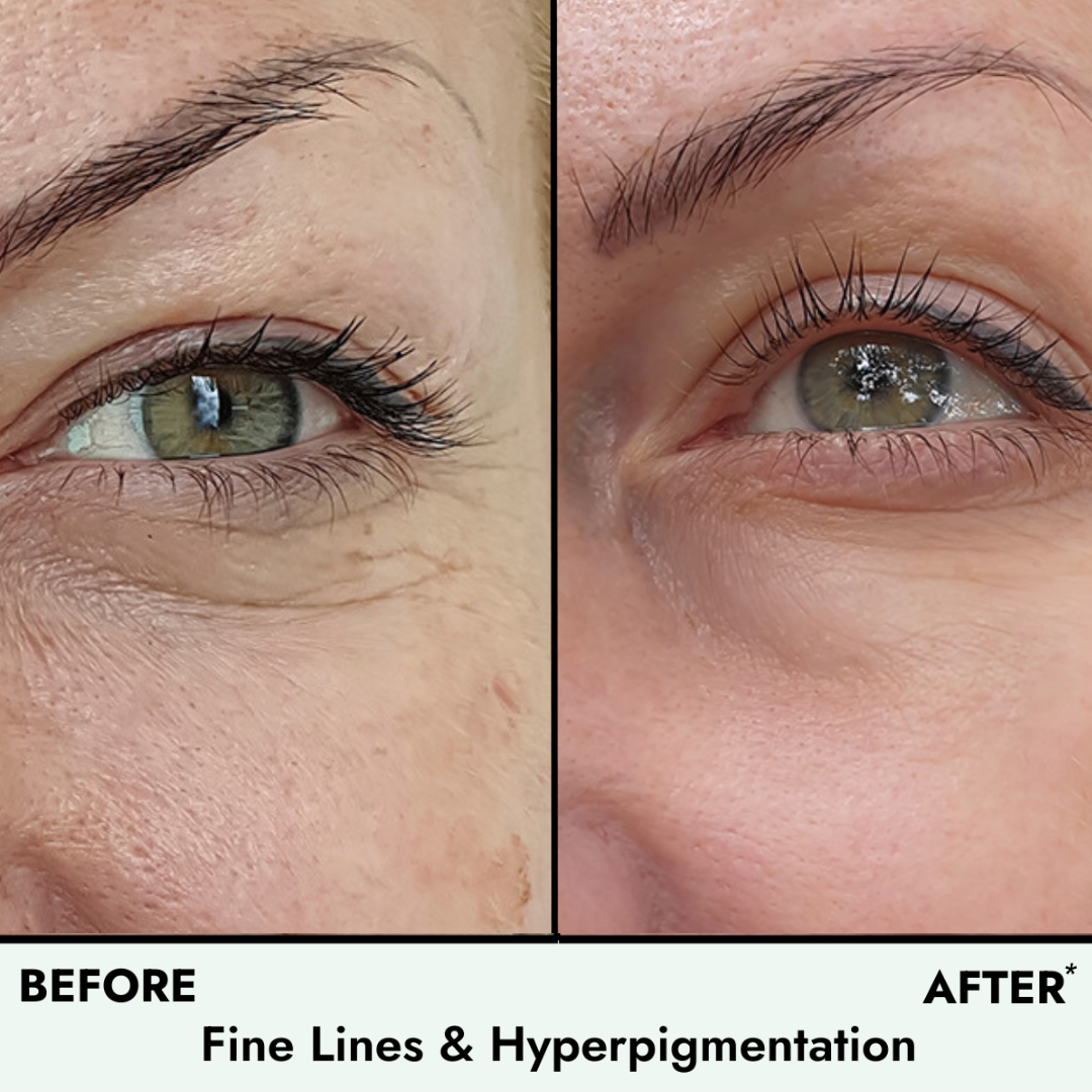 Anti Aging Cream - Daily Ritual